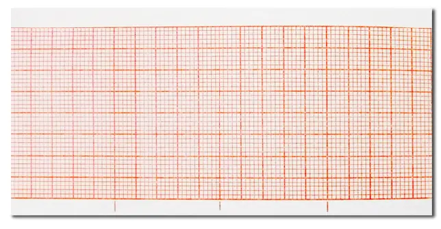 Rollo de papel grado médico de 210mm x 30m (para electrocarfiografo) C/100 (copia)